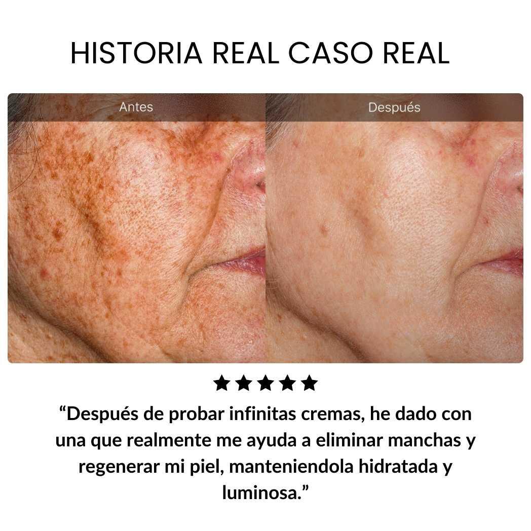 Crema Dragon Blood — Reduce Arrugas y Manchas en 7 Días