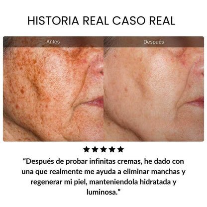 Crema Dragon Blood — Reduce Arrugas y Manchas en 7 Días